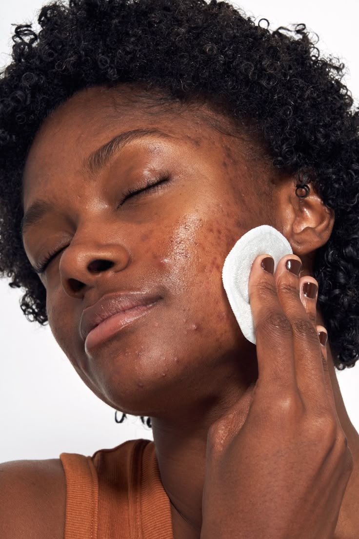 🔄 Combination Skin: How to Balance Oily and Dry Areas Without Causing Breakouts